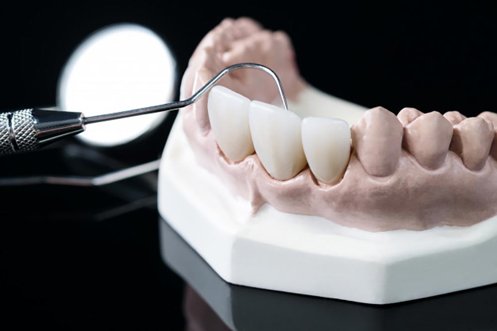 Aesthetic dentistry