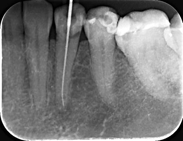 Endodontics x-ray room