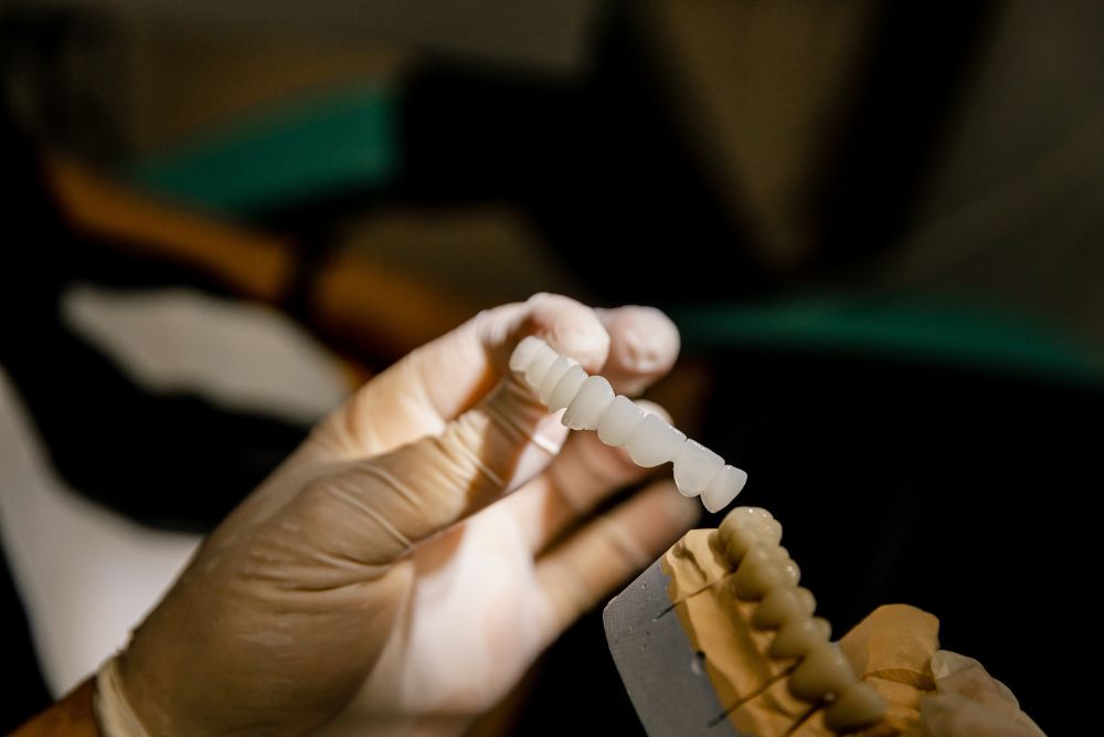 immediate implant placement dr veselinović 4