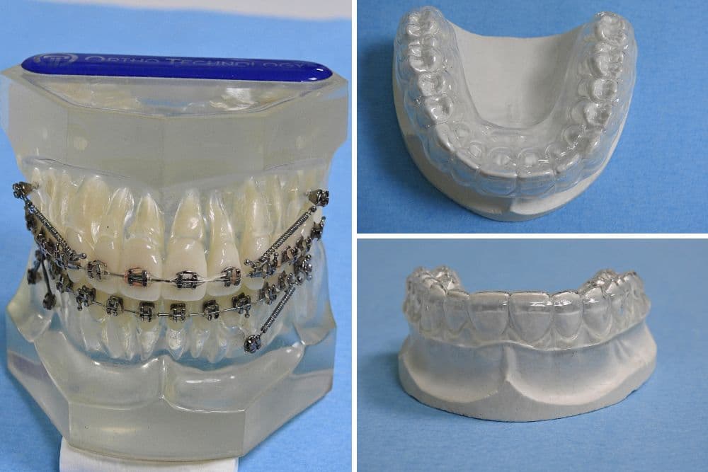 retainers dr veselinović 2