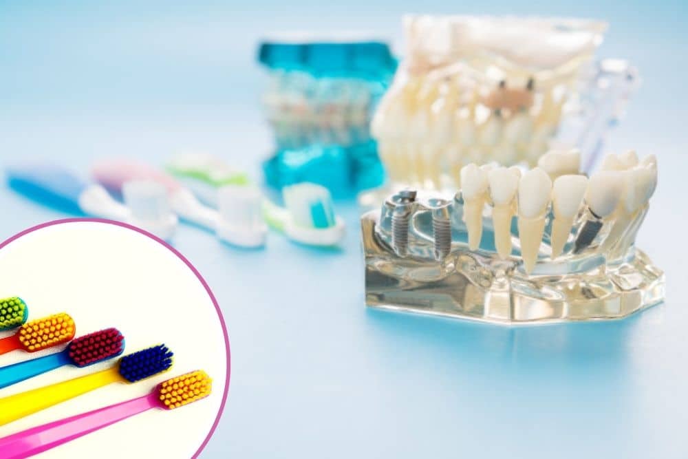 maintenance of dental implant hygiene dr veselinovic 3