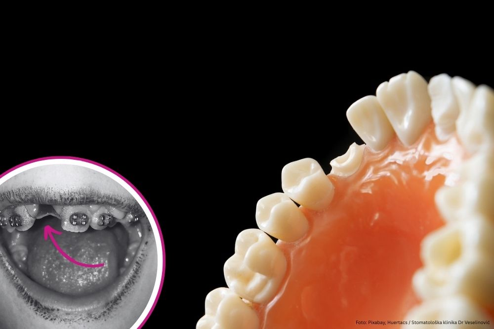 dental injuries dr veselinovic 1