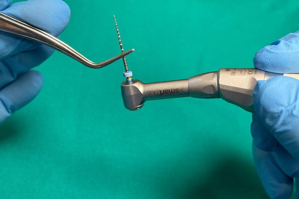 endodontic therapy dr veselinovic 2