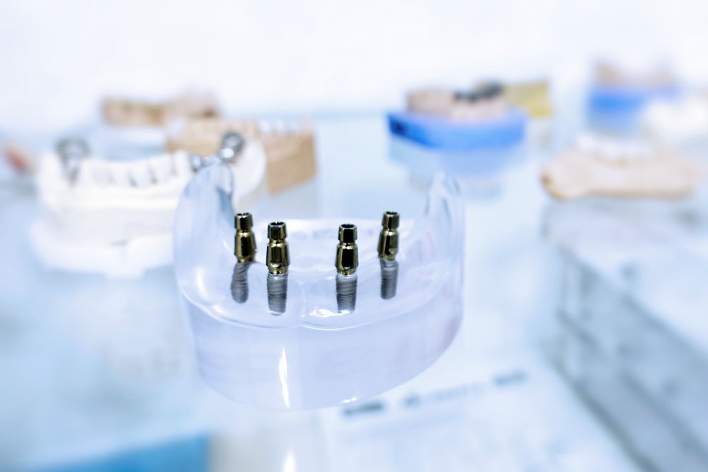 all on 4 dr veselinović 2