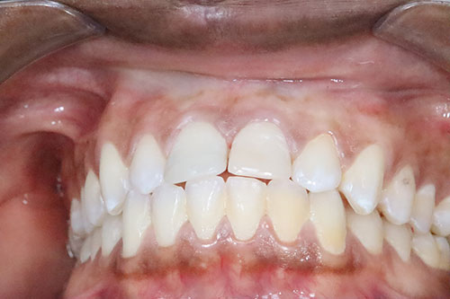 Parapulparni Kočići