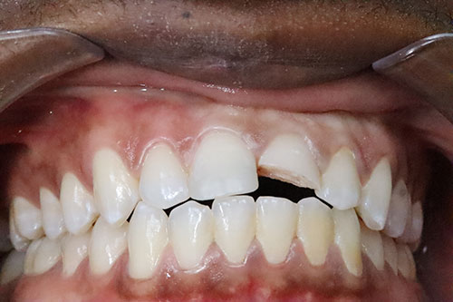 Parapulparni Kočići