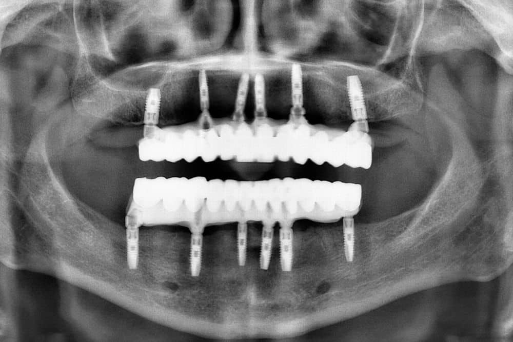 all on 6 dr veselinovic 1 1