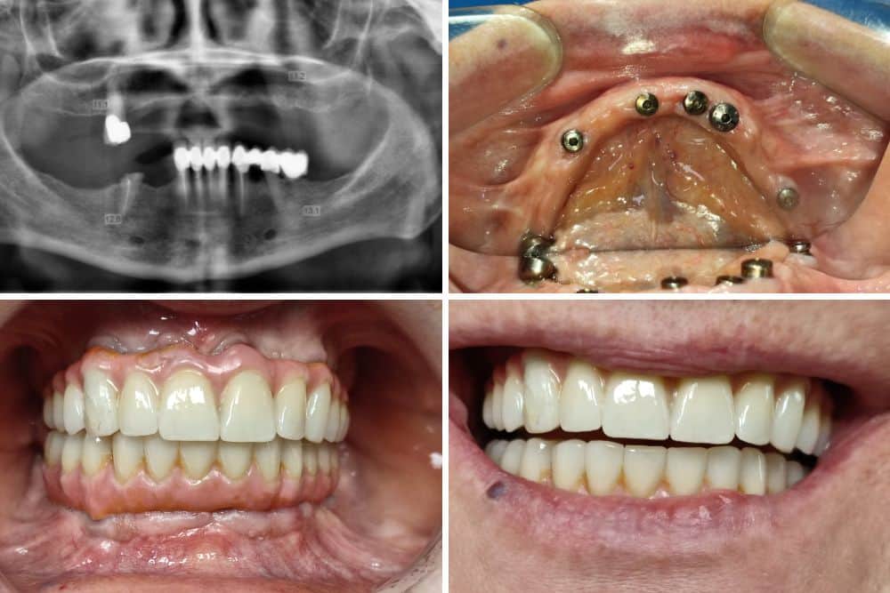 all on 6 dr veselinovic 3