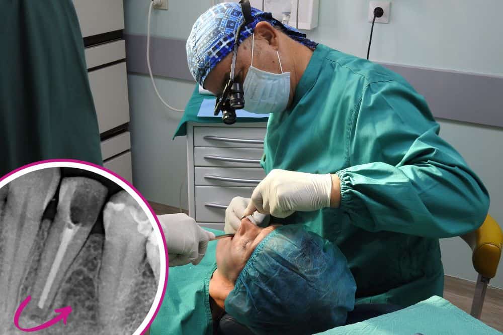 sta-je-apikotomija-dr-veselinović-1 sta je apikotomija dr veselinović 1