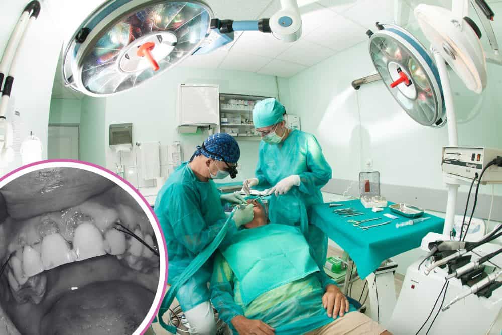 recesija-gingive-dr-veselinović-1 recesija gingive dr veselinović 1