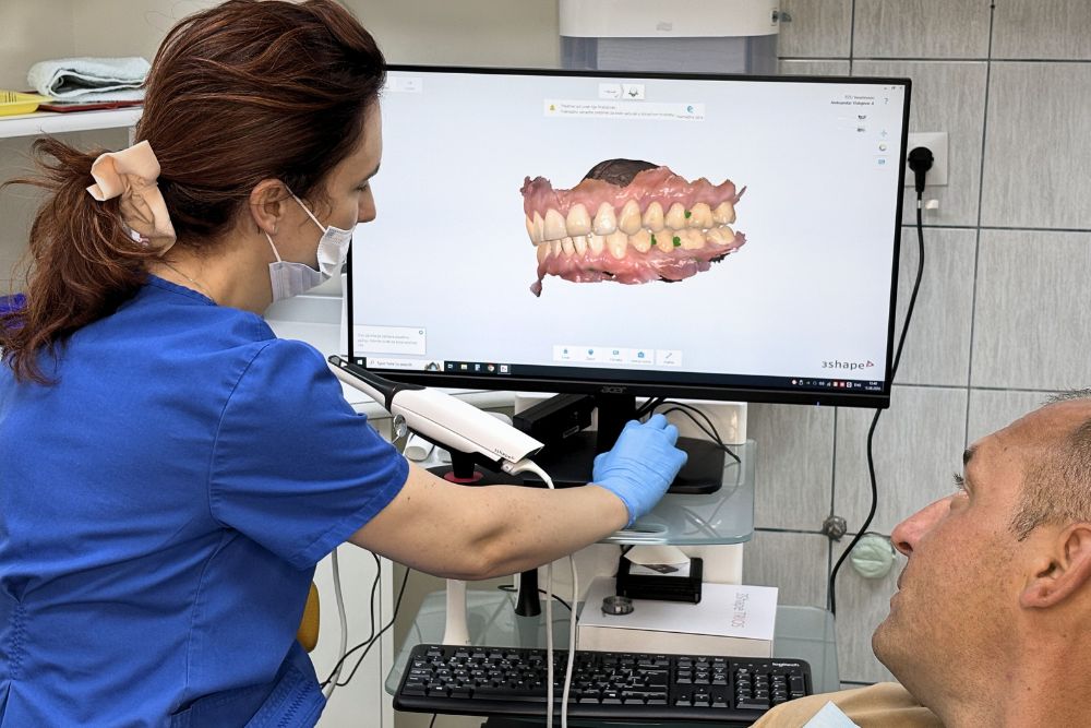 intraoralni skener dr veselinović 3